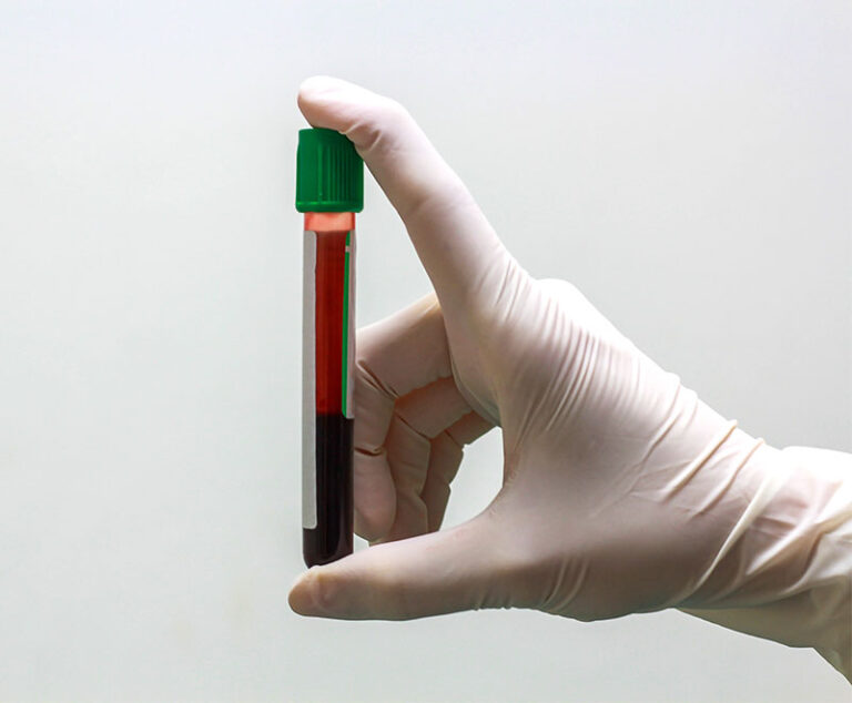 FDA Approves First Coagulation Factor-Albumin Fusion Protein to Treat Hemophilia B