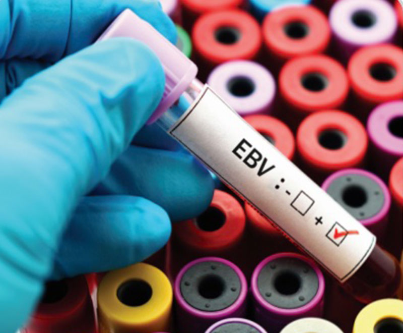 Photo of a gloved hand holding a blood vial labeled with EPV