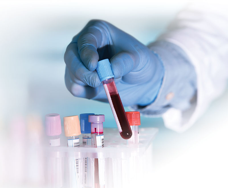 Photo of a researcher holding a vial of blood.