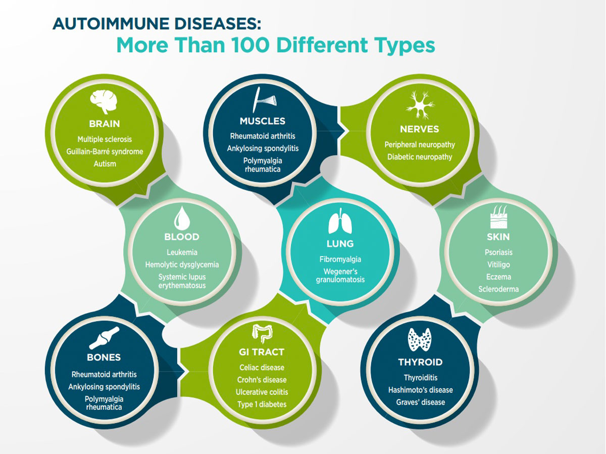Autoimmune diseases: more than 100 different types
