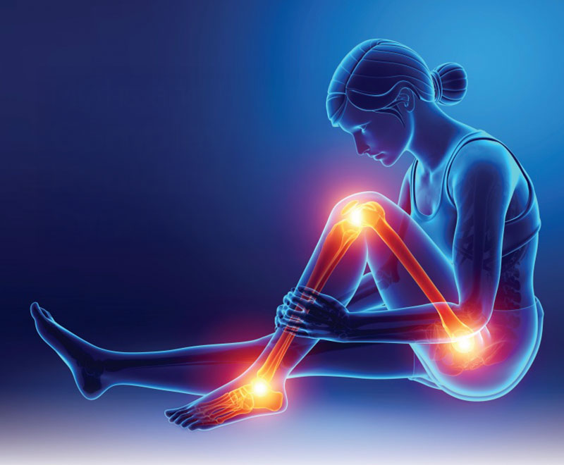 Illustration of a woman experiencing leg pain