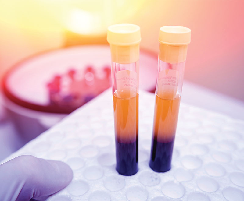 Image of blood vials