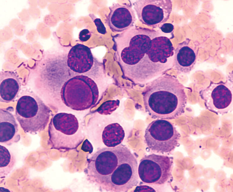 cancer cells