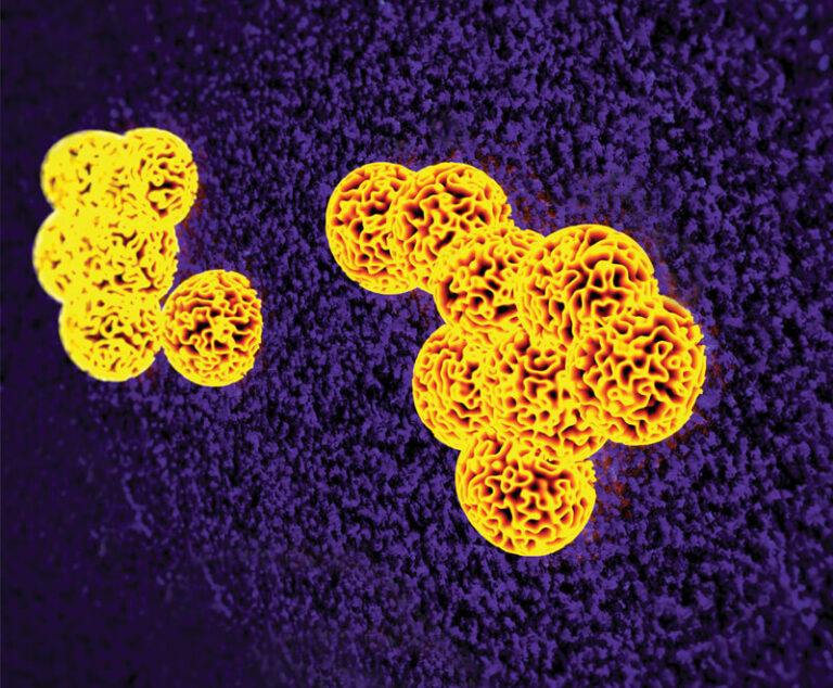BioSupply Trends Quarterly Spring 2017 Superbugs