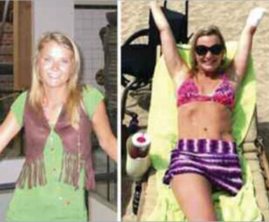 Photo of Aimee Copeland who lost her limbs to a deadly flesh-eating bacteria