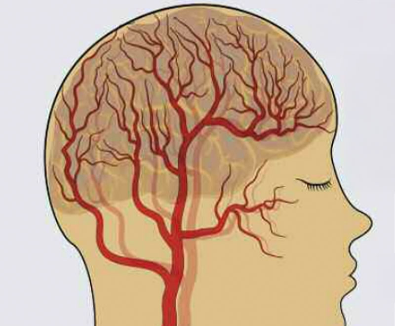 Illustration of human head/brain with blood vessels