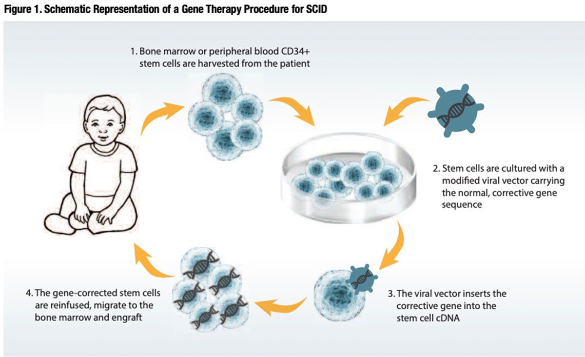 Figure 1: Schematic Representation of a Gene Therapy Procedure for SCID