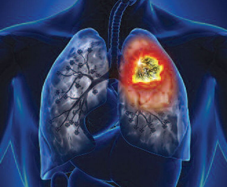 FDA Approves Keytruda to Treat Lung Cancer