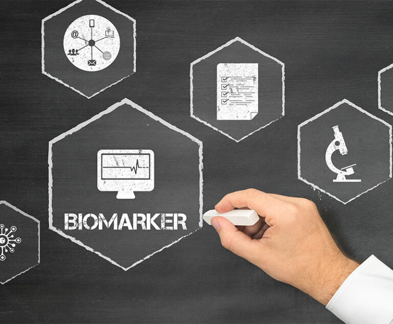 Biomarker Found in CIDP Patients Who Don't Respond to IVIG Therapy