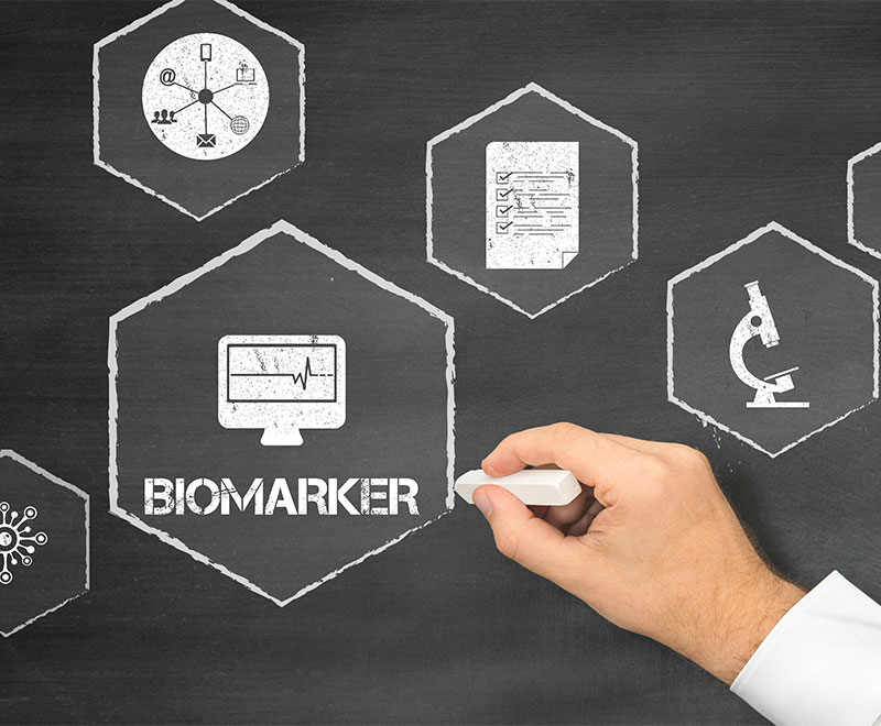 Biomarker Found in CIDP Patients Who Don't Respond to IVIG Therapy