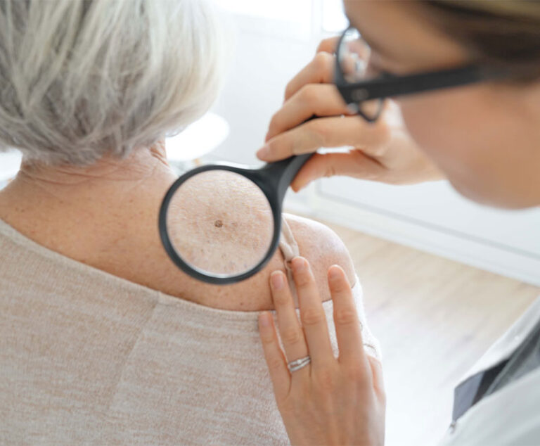 FDA Expands Approval of Combination Therapy for Melanoma