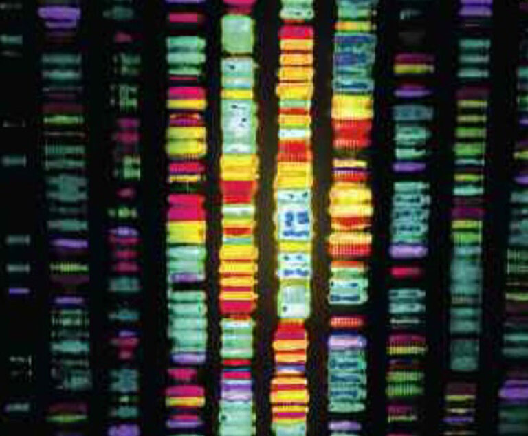 Genome Sequencing Uncovers New Autoimmune Syndrome
