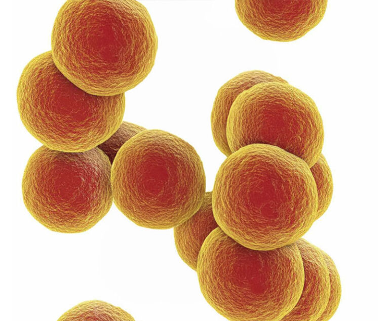 Myths and Facts: Bacterial Skin Infections