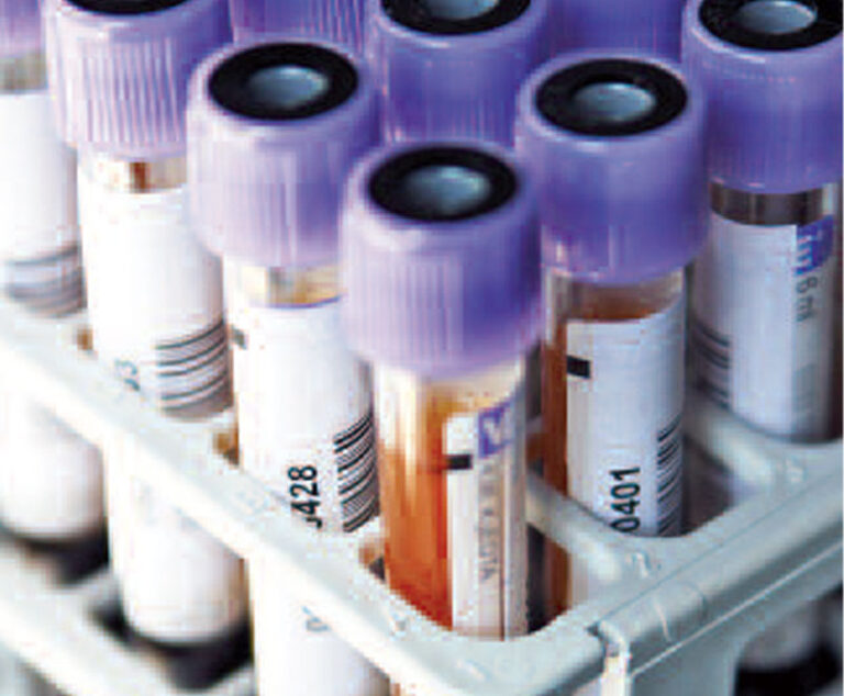 Photo of blood sample vials
