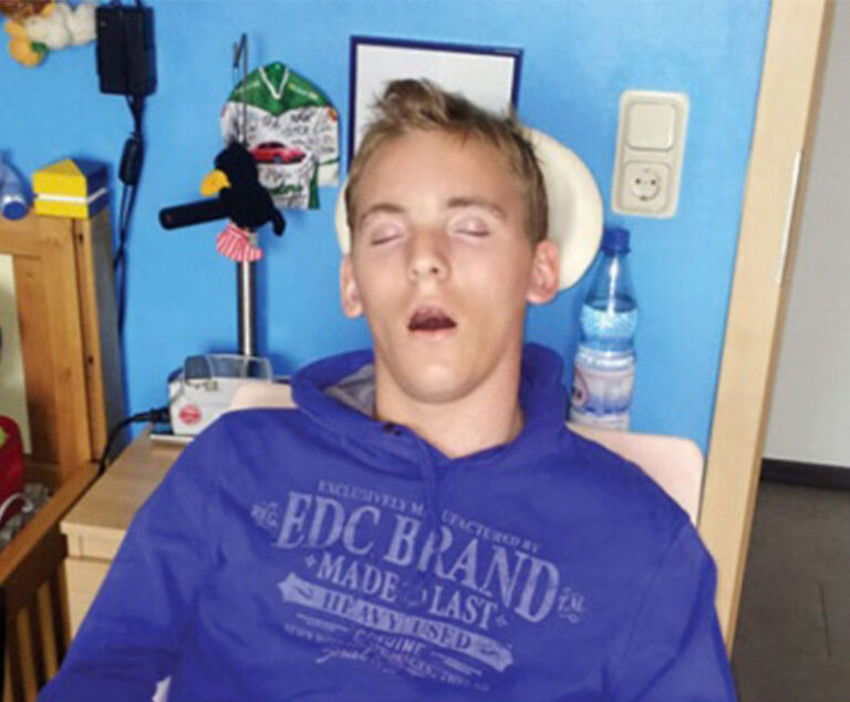 measles patient