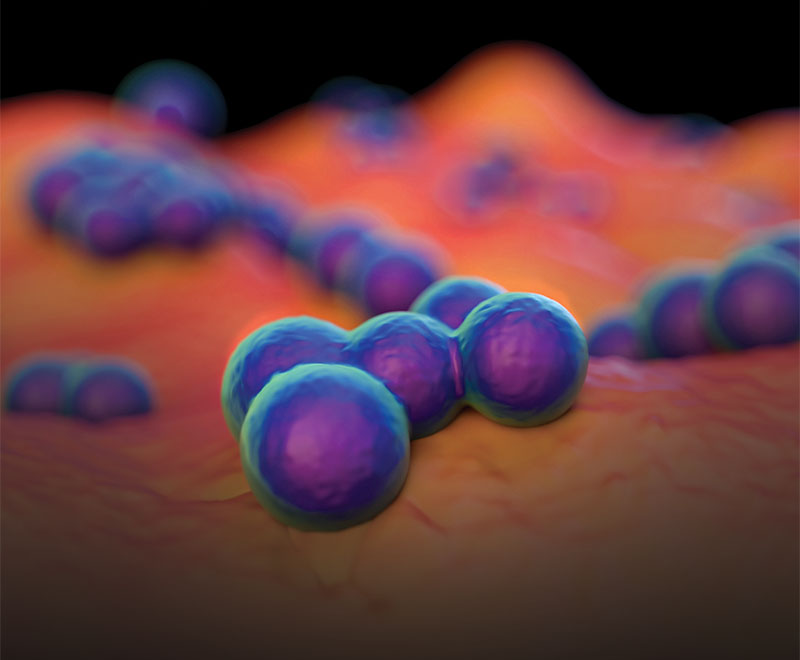 Colorized image of MRSA on cell surface.