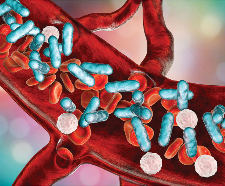 Colorized graphic showing sepsis in a blood vessel.