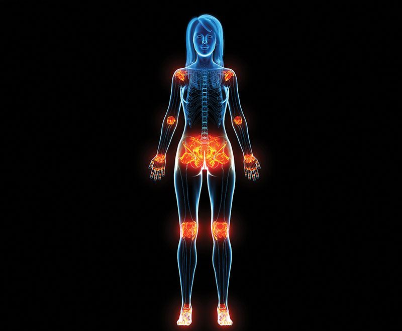 X-ray-like Concept image of a woman's body showing areas of inflammation.