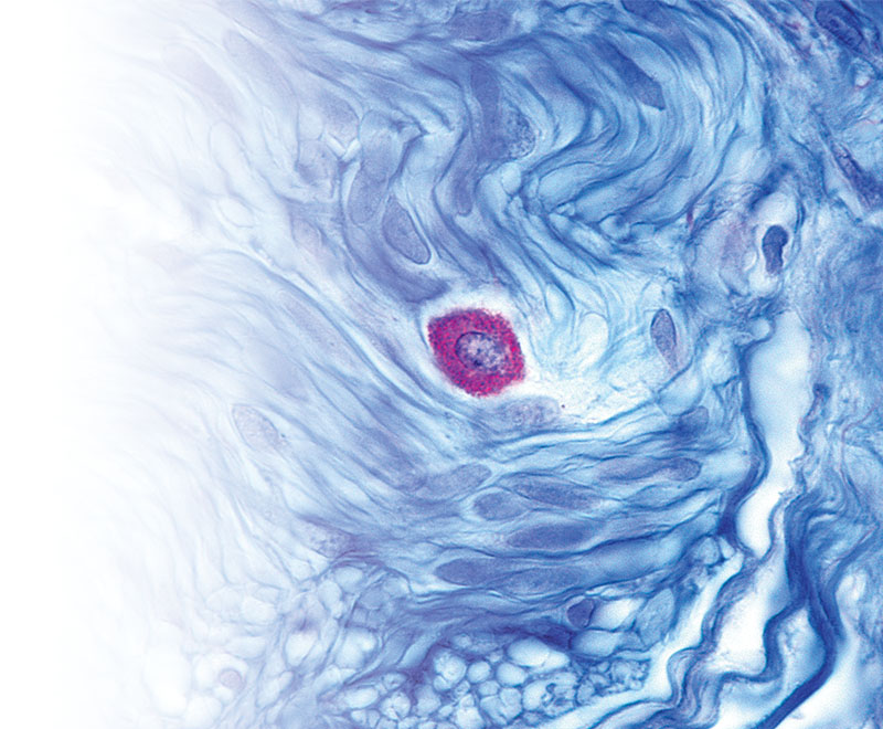 Microscopic image of a mast cell.